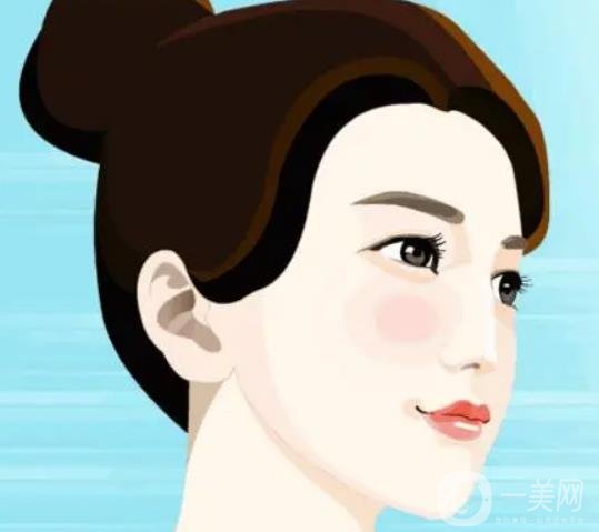 假體下巴多久恢復(fù)？恢復(fù)過(guò)程怎樣的？